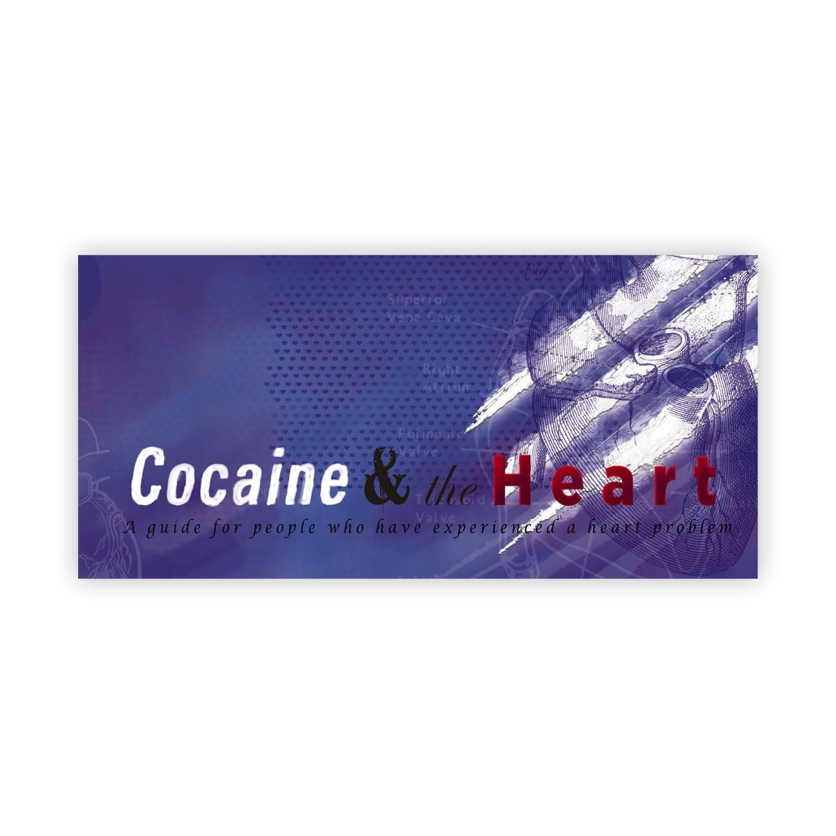 Cocaine and the heart 