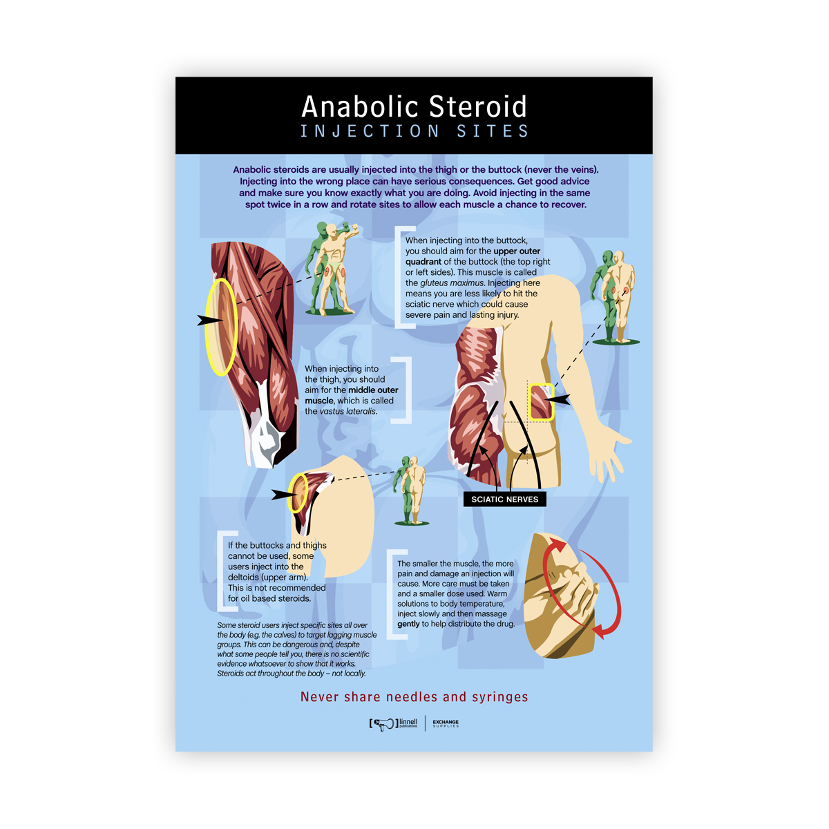 Anabolic Steroid Injection Sites Poster